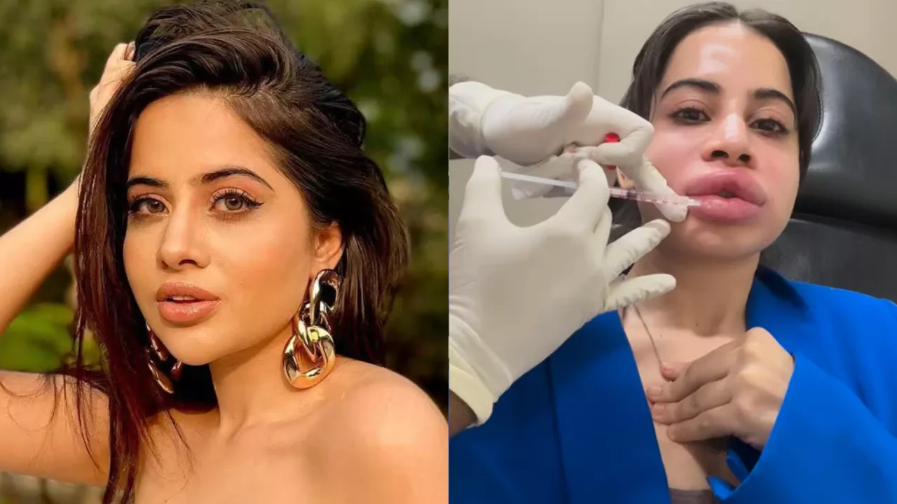 अब पहले जैसा दिखने लगा उर्फी जावेद का चेहरा — लिप फिलर हटाने के बाद नॉर्मल रूप