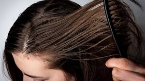 मानसून हेयर केयर: ऑयली स्कैल्प से राहत के 5 आसान नुस्खे