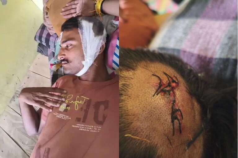 लखनऊ एम्बुलेंस चालक हमला: दबंगों ने सिर पर लोहे की रॉड से किया वार