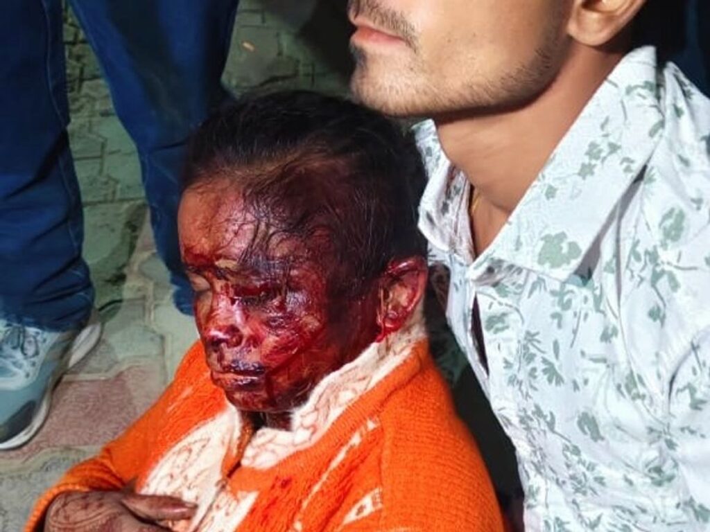 लखनऊ में पति की दरिंदगी: पत्नी झाड़ियों में मिली घायल