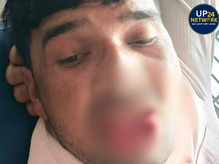 कानपुर: किस विवाद में लड़की ने लड़के की जीभ काटी