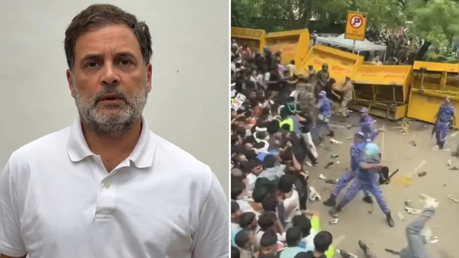 घायल छात्रों से मिले राहुल गांधी, पूछा- ‘प्रधानमंत्री चुप क्यों हैं?’; पुलिस कार्रवाई पर मांगा जवाब 5 Rahul Gandhi meets students injured during CJP Parliament march at RML Hospital