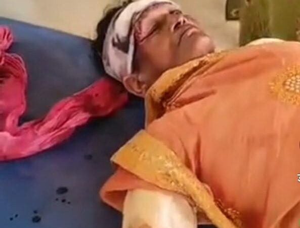 जालौन में महानवमी पर बड़ा हादसा, जवारे चढ़ाने जा रही श्रद्धालुओं से भरी ट्रैक्टर-ट्रॉली पलटी, 25 तक घायल 5 जालौन में महानवमी पर हादसा, जालौन ट्रैक्टर ट्रॉली दुर्घटना, उरई हादसा आज, जालौन की ताजा खबर, उत्तर प्रदेश सड़क हादसा, नदीगांव थाना क्षेत्र दुर्घटना, सद्दूपुरा कनासी मार्ग हादसा, जवारे चढ़ाने जा रहे श्रद्धालु घायल, महानवमी पर ट्रैक्टर ट्रॉली पलटी, जालौन दुर्घटना समाचार, कोंच सीएचसी में घायल भर्ती, जालौन लोकल न्यूज, यूपी हादसा समाचार, जालौन जिला समाचार,Jalaun accident news, Jalaun Mahanavami accident, Jalaun tractor trolley accident, Urai accident news, Uttar Pradesh accident news, Nadigaon police station accident, Saddupura Kanasi road accident, devotees injured in Jalaun, tractor trolley overturned in Jalaun, Mahanavami devotees accident UP, injured devotees admitted to CHC Konch, Jalaun latest news, Uttar Pradesh local news, Jalaun district news,#जालौन_हादसा, #जालौन_न्यूज, #उरई_समाचार, #महानवमी, #ट्रैक्टर_ट्रॉली_हादसा, #उत्तरप्रदेश_समाचार, #नदीगांव, #कोंच, #JalaunAccident, #JalaunNews, #UraiNews, #MahanavamiAccident, #UPNews, #UttarPradeshNews,