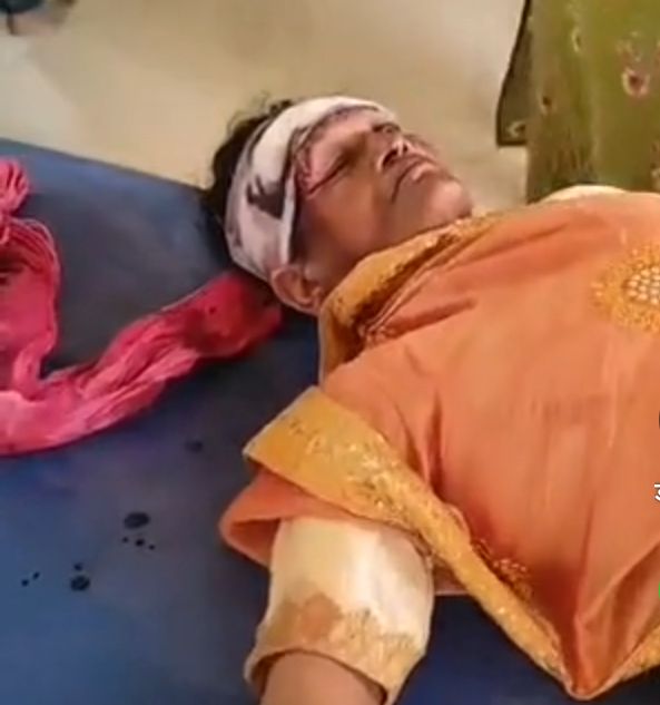 जालौन में महानवमी पर हादसा, जालौन ट्रैक्टर ट्रॉली दुर्घटना, उरई हादसा आज, जालौन की ताजा खबर, उत्तर प्रदेश सड़क हादसा, नदीगांव थाना क्षेत्र दुर्घटना, सद्दूपुरा कनासी मार्ग हादसा, जवारे चढ़ाने जा रहे श्रद्धालु घायल, महानवमी पर ट्रैक्टर ट्रॉली पलटी, जालौन दुर्घटना समाचार, कोंच सीएचसी में घायल भर्ती, जालौन लोकल न्यूज, यूपी हादसा समाचार, जालौन जिला समाचार,Jalaun accident news, Jalaun Mahanavami accident, Jalaun tractor trolley accident, Urai accident news, Uttar Pradesh accident news, Nadigaon police station accident, Saddupura Kanasi road accident, devotees injured in Jalaun, tractor trolley overturned in Jalaun, Mahanavami devotees accident UP, injured devotees admitted to CHC Konch, Jalaun latest news, Uttar Pradesh local news, Jalaun district news,#जालौन_हादसा, #जालौन_न्यूज, #उरई_समाचार, #महानवमी, #ट्रैक्टर_ट्रॉली_हादसा, #उत्तरप्रदेश_समाचार, #नदीगांव, #कोंच, #JalaunAccident, #JalaunNews, #UraiNews, #MahanavamiAccident, #UPNews, #UttarPradeshNews,