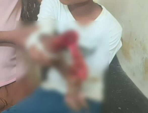 जालौन में चारा काटते समय दर्दनाक हादसा, 14 वर्षीय किशोर का हाथ कटा; हालत गंभीर 5 जालौन के कदौरा में चारा काटने वाली इलेक्ट्रिक मशीन से घायल 14 वर्षीय किशोर,#JalaunNews #KadauraNews #OraiNews #UttarPradeshNews #AccidentNews #जालौन #कदौरा #उरई #उत्तरप्रदेशसमाचार,Jalaun accident news, Kadaura accident, Mumtazabad village news, fodder cutting machine accident, 14 year old boy injured, electric chaff cutter accident, Haseed Beg accident, Orai latest news, Uttar Pradesh news,जालौन चारा मशीन हादसा, जालौन दुर्घटना समाचार, कदौरा हादसा, मुमताजाबाद गांव की खबर, हसीद बेग हादसा, 14 वर्षीय किशोर घायल, चारा काटने वाली मशीन से हादसा, इलेक्ट्रिक चारा मशीन दुर्घटना, उरई ताजा खबर, जालौन क्राइम और दुर्घटना समाचार, उत्तर प्रदेश ताजा समाचार,