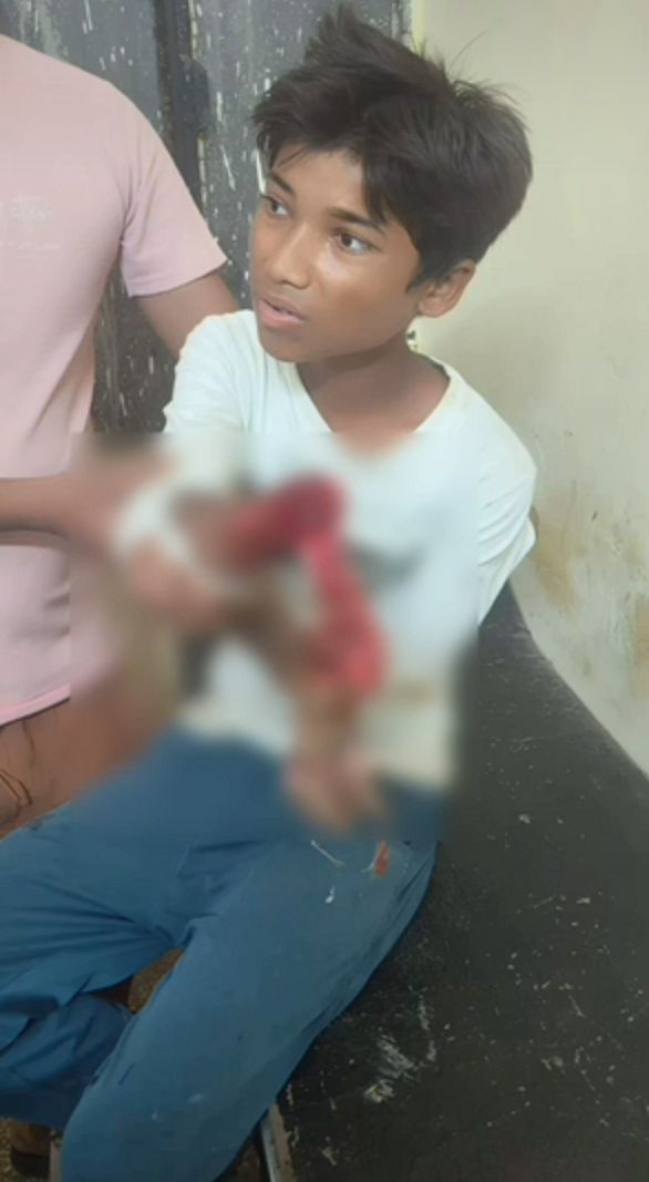 जालौन के कदौरा में चारा काटने वाली इलेक्ट्रिक मशीन से घायल 14 वर्षीय किशोर,#JalaunNews #KadauraNews #OraiNews #UttarPradeshNews #AccidentNews #जालौन #कदौरा #उरई #उत्तरप्रदेशसमाचार,Jalaun accident news, Kadaura accident, Mumtazabad village news, fodder cutting machine accident, 14 year old boy injured, electric chaff cutter accident, Haseed Beg accident, Orai latest news, Uttar Pradesh news,जालौन चारा मशीन हादसा, जालौन दुर्घटना समाचार, कदौरा हादसा, मुमताजाबाद गांव की खबर, हसीद बेग हादसा, 14 वर्षीय किशोर घायल, चारा काटने वाली मशीन से हादसा, इलेक्ट्रिक चारा मशीन दुर्घटना, उरई ताजा खबर, जालौन क्राइम और दुर्घटना समाचार, उत्तर प्रदेश ताजा समाचार,