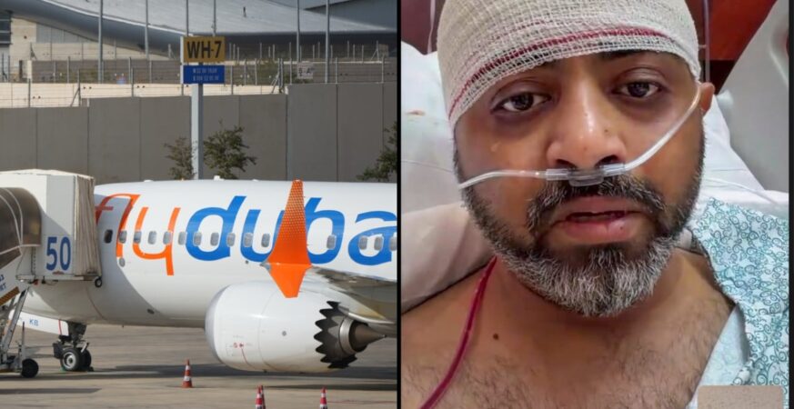 Flydubai FZ1073 के भारतीय पायलट Smit Machchhar की खोपड़ी में गंभीर फ्रैक्चर, सऊदी अरब में हुई Emergency Surgery 5 Flydubai FZ1073 के भारतीय पायलट Smit Machchhar की fractured skull के बाद हुई emergency surgery