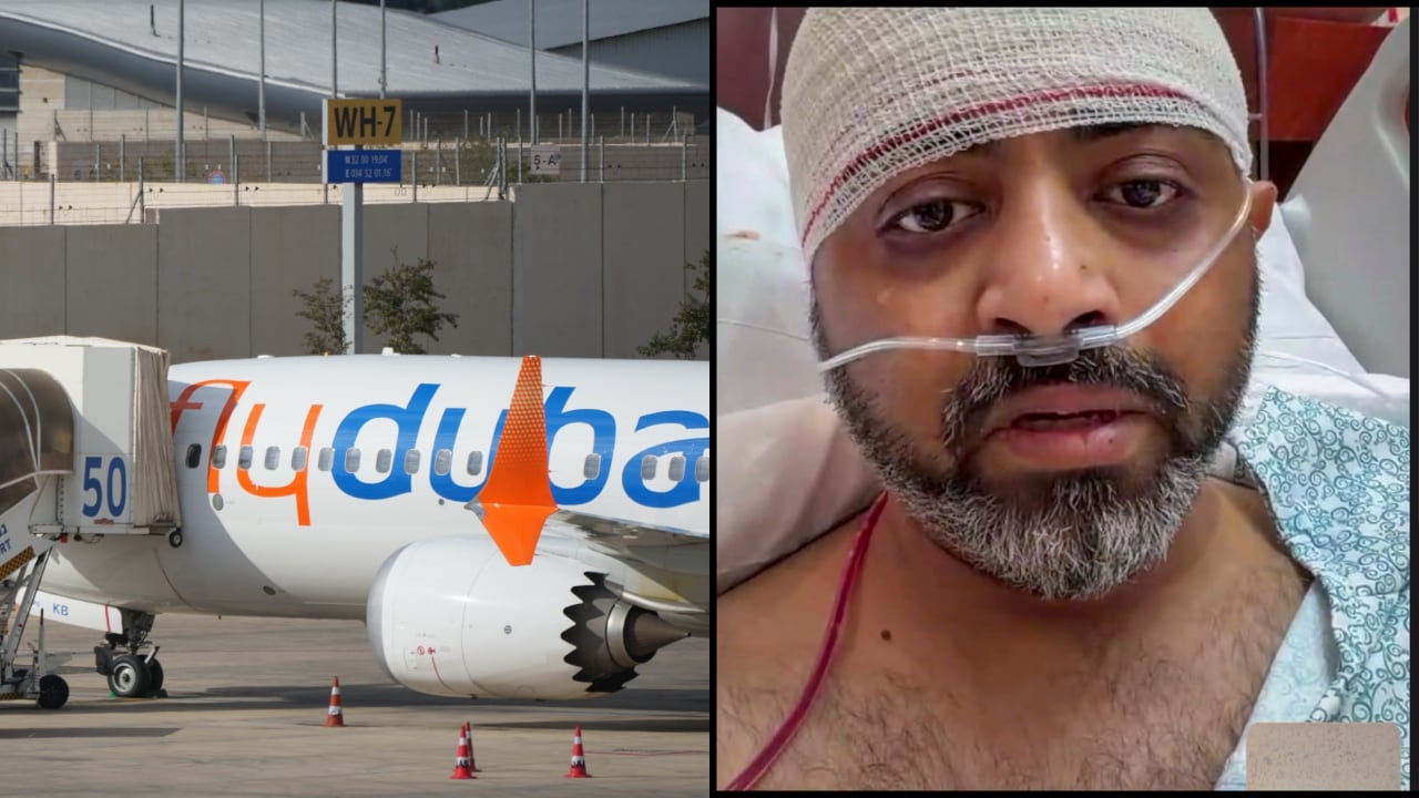 Flydubai FZ1073 के भारतीय पायलट Smit Machchhar की fractured skull के बाद हुई emergency surgery